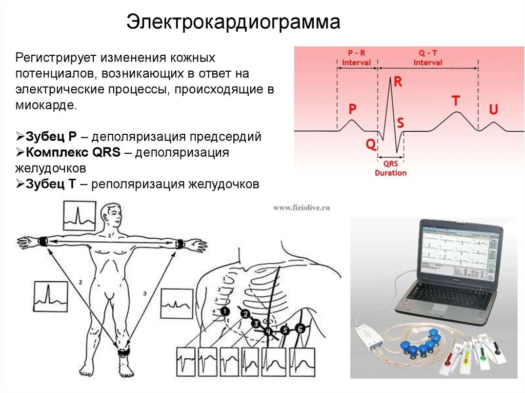 Рисунок кардиограммы как называется